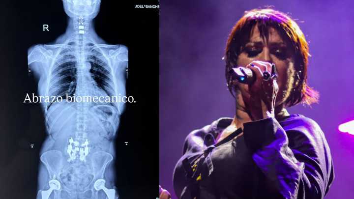 Alejandra Guzmán revela imagen tras cirugía de columna