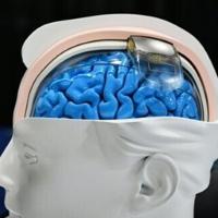 'We're already living in science fiction': The neurotech revolution