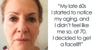 Woman Shares Her Aging Progress And How She Looks After Getting A Facelift At 70 Years Old