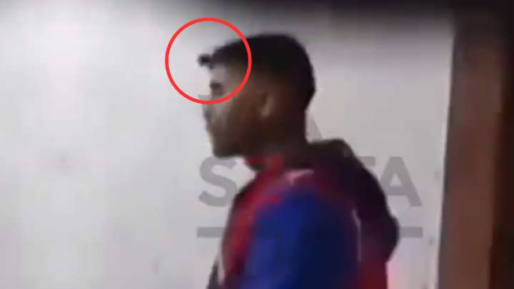 IMÁGENES SENSIBLES: A un jugador argentino le incrustaron una llave en su frente