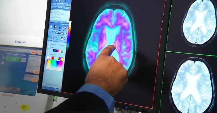 Health news: Dementia is now officially the leading cause of death in Australia