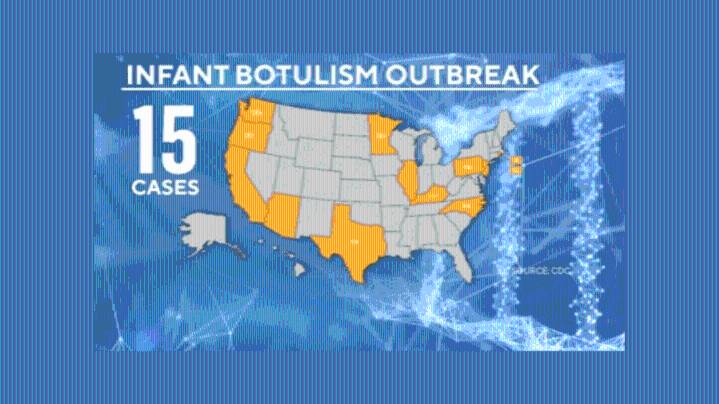 No cases of infant botulism in New Mexico amid outbreak, according to health officials