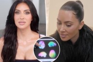 Kim Kardashian's brain scan shows 'low activity' after aneurysm