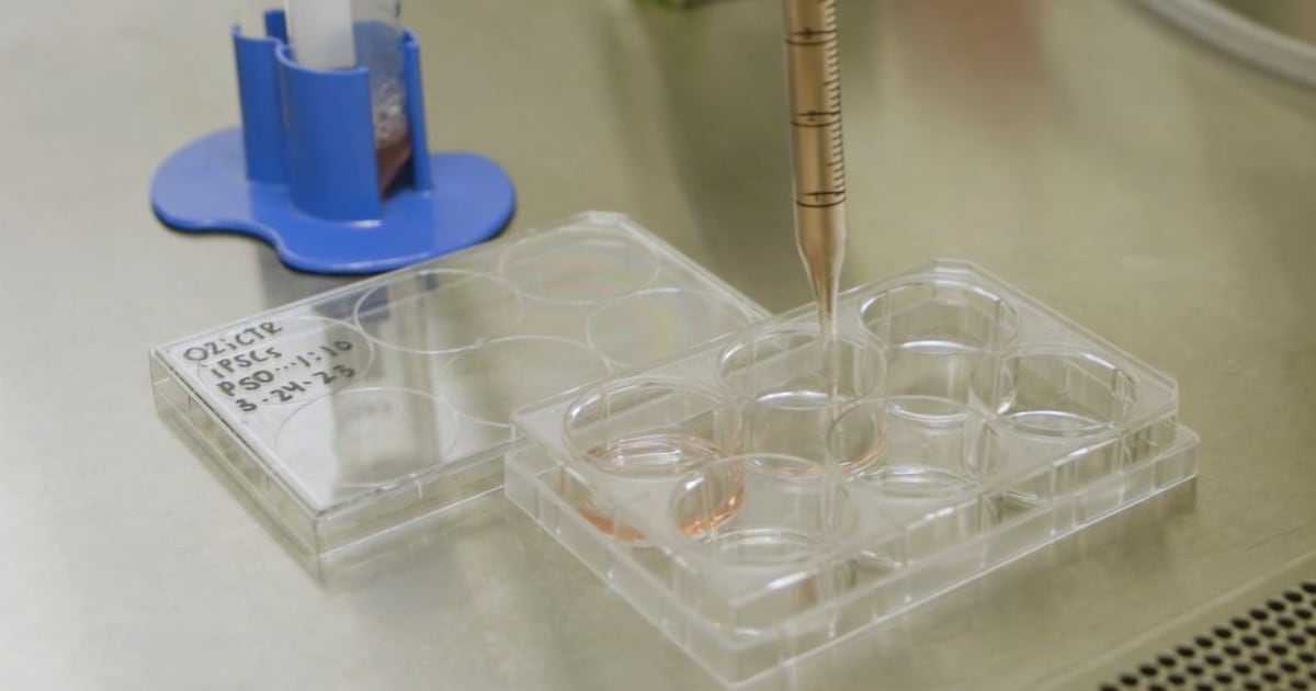 Medicina regenerativa abre una nueva esperanza para pacientes con enfermedades crónicas