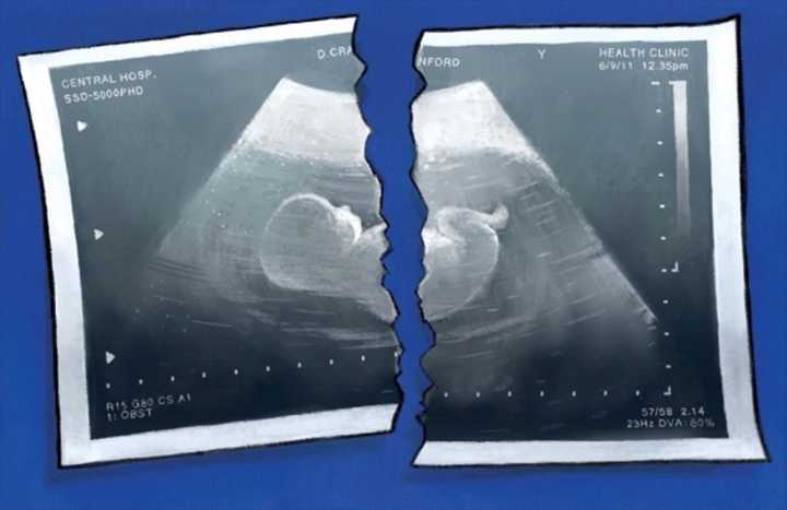 The SNP have crossed the line on abortion