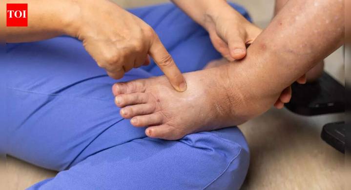 Why your ankles swell: Experts reveal 10 hidden causes, including early signs of heart failure