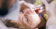 Calls grow for banning mercury in dental fillings by 2030