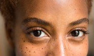 Changes In Your Skin Microbiome May Lead To Less Collagen, Research Suggests