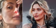 La hija de Michael Jackson mostró el “hueco en la nariz” que le dejó el abuso de drogas