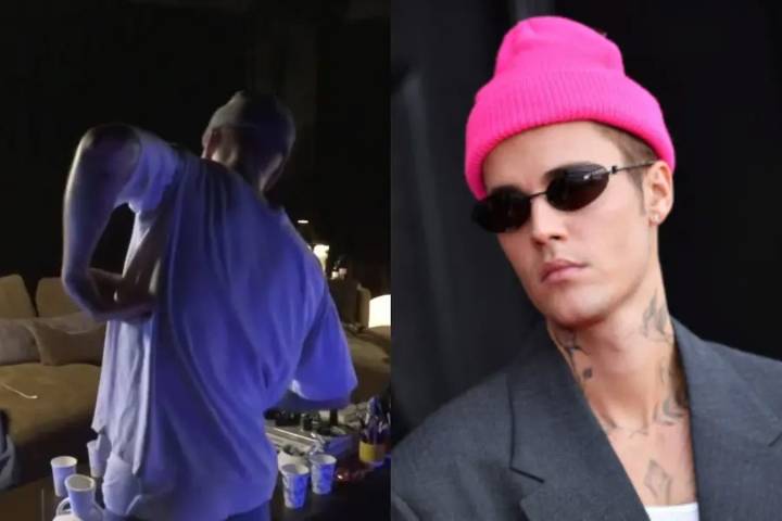 Everything hurts: Justin Bieber after falling from electric skateboard