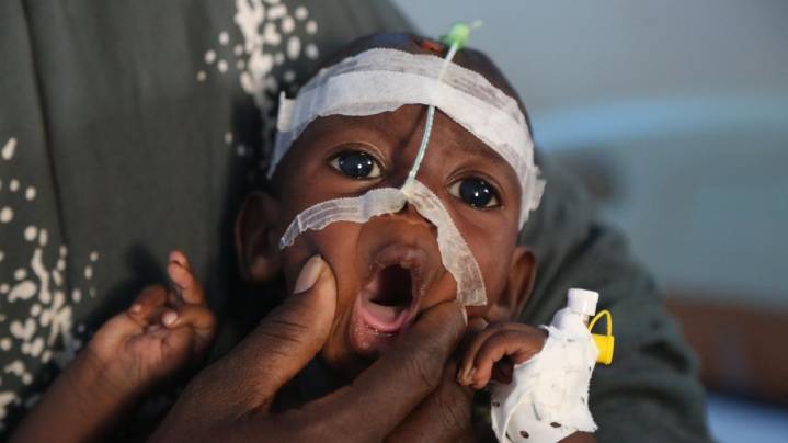 A visit to Somalia's crumbling hospitals shows the toll of aid cuts and war