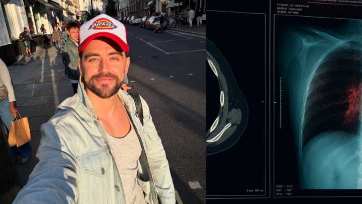 Actor con cáncer perdió medio pulmón tras confundir los síntomas con gripa: 'Ninguna palabra podrá describir esta profunda tristeza'