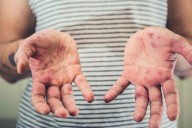 Alerta sarampión. El mapa del recorrido que hizo la familia contagiada a bordo de tres ómnibus de larga distancia