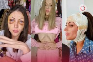 Estas son algunas de las 27 cirugías que pusieron en riesgo la vida de la “Barbie humana”, Bárbara Jankavski