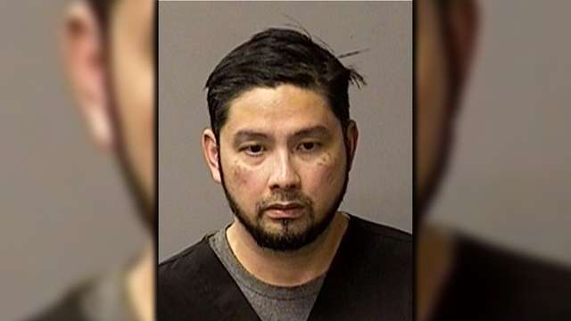 Turlock technician accused of sexually assaulting woman during procedure