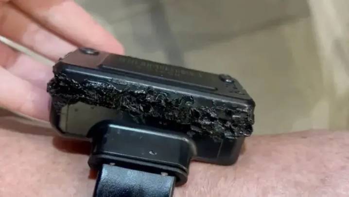 Bolsonaro intentó quemar su tobillera electrónico por paranoia