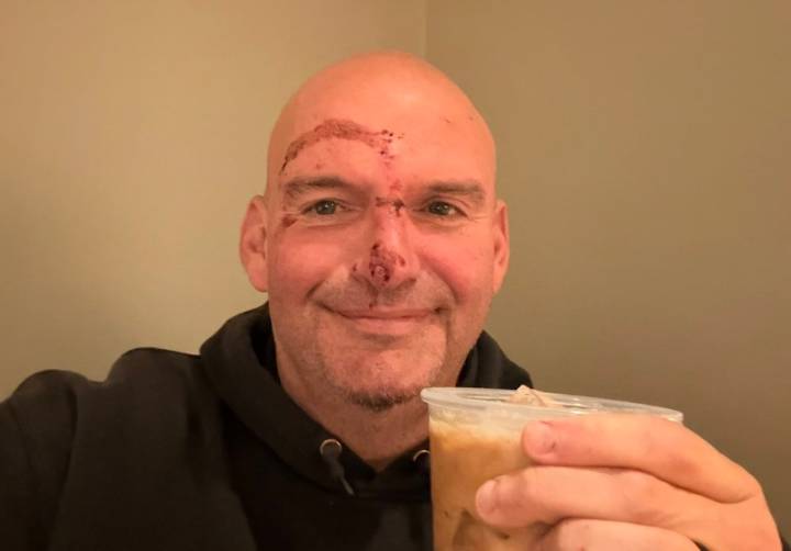 Sen. John Fetterman says he needed 20 stitches after fall