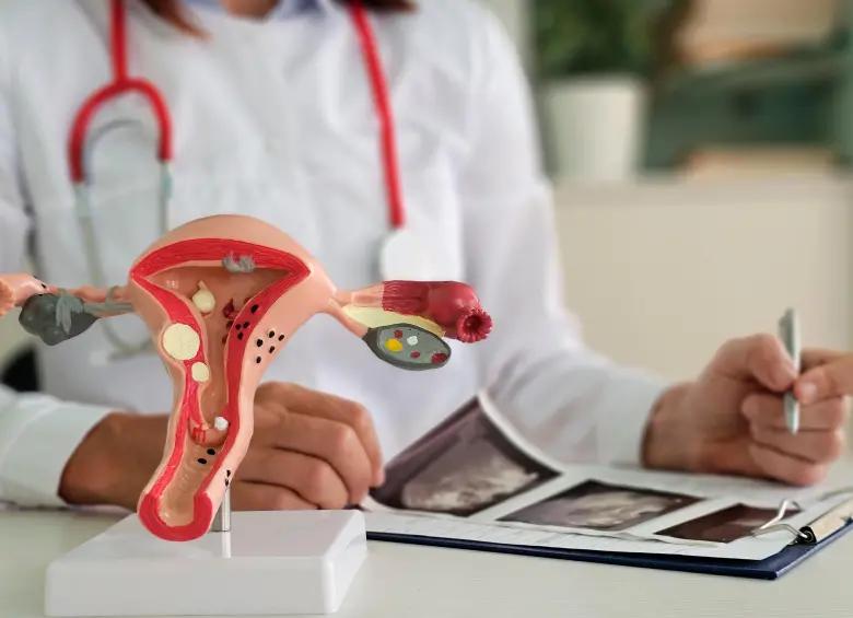 Avances de la Ley de Endometriosis en Colombia: qué ha pasado y qué falta