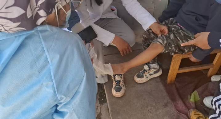 Personal de salud en Huancayo no tiene guantes para realizar el chequeo por virus de coxsackie