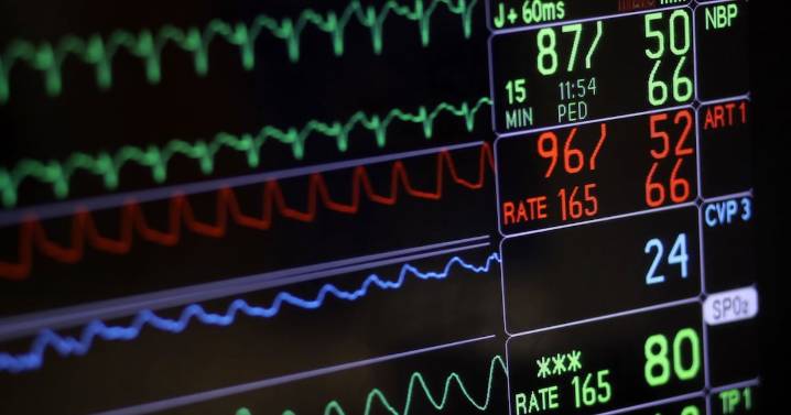 Blood thinners not needed for many with irregular heartbeat: study