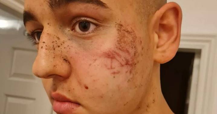 'My life got flipped upside down' - Teen rugby star's career in tatters after rival player kicks him in face