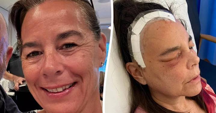 'Doctors put my flu-like symptoms down to fibromyalgia - but it turned out I had a brain tumour'