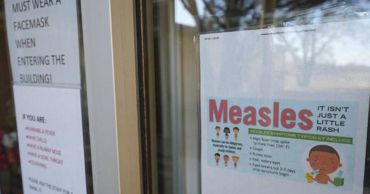 Louisiana health officials confirm state's third measles case, warn of public exposure at MSY