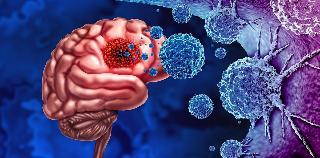 Traces Of Bacteria Found In Brain Tumors