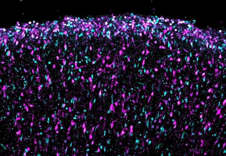 El primer mapa del cerebro en formación permite vislumbrar el origen de los trastornos de la mente
