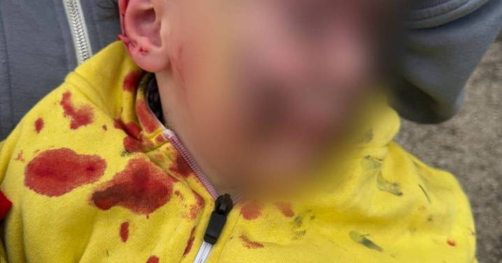 Boy left with 'life-altering injuries' after being attacked by off