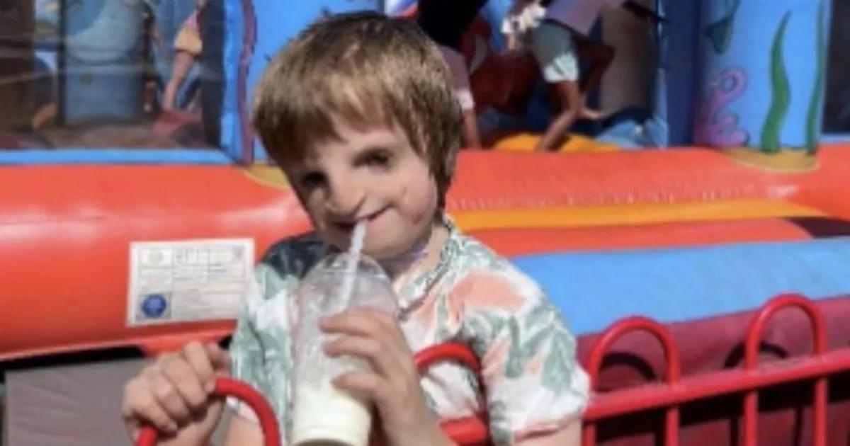 Boy, 7, gets jaw rebuilt using his own ribs in seven-hour op so he can go to sleepovers