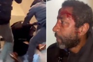 Brooklyn spitter left bloodied by two men 'tired' of his vile antics