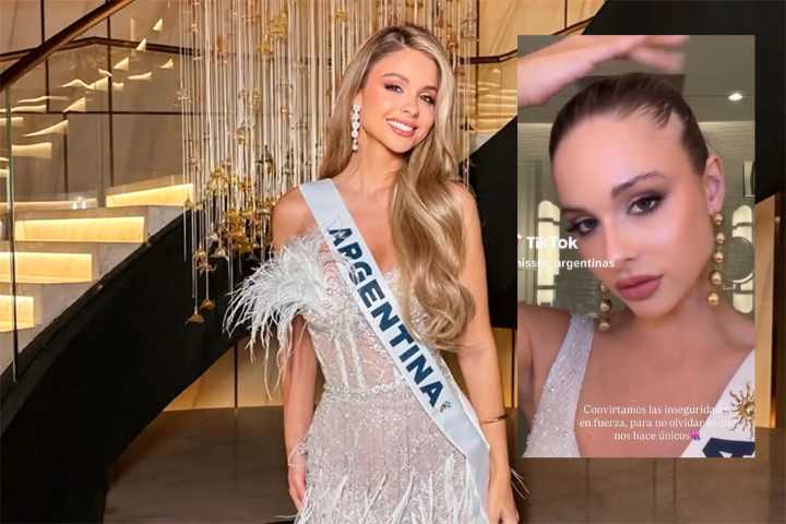 “Tengo alopecia”, el conmovedor mensaje de la entrerriana Miss Universo Aldana Masset