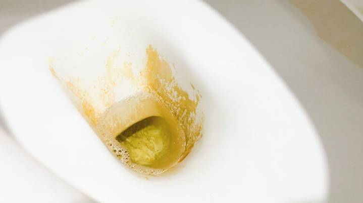 8 Foolproof Ways To Remove The Toughest Limescale Stains From The Toilet