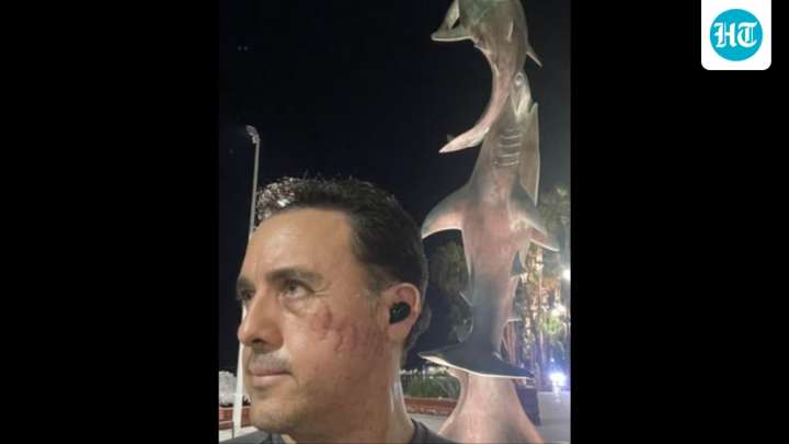 Biologist recalls being bitten in head by shark: 'I felt the pressure of bite'