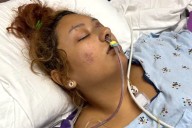 Georgia Woman Has Leg Severed by Car During Bike Ride with Boyfriend