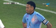 Clamoroso blooper de Pedro Gallese provocó gol de Rusia ante Perú en amistoso FIFA 2025
