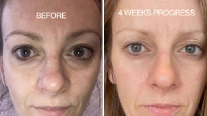 Get 35 per cent off $100 serum transforming menopausal skin this Black Friday: Edible Beauty