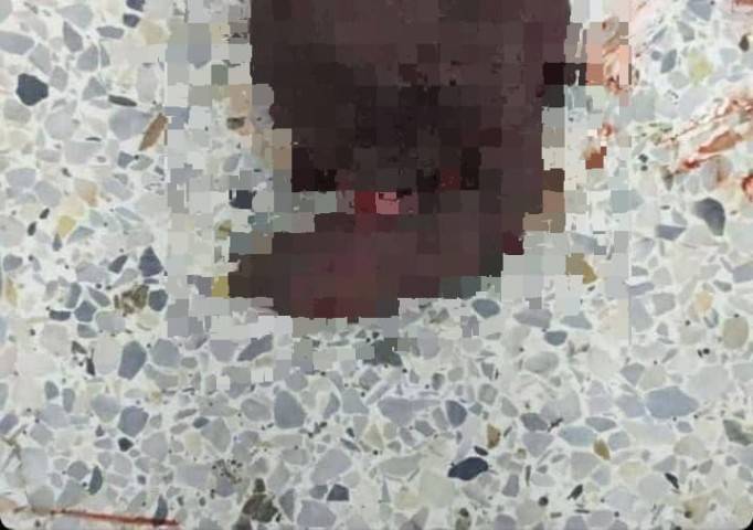 Mujer le amputa el pene a su pareja por motivos pasionales