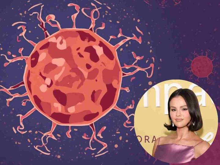 Estudio revela que el lupus podría ser causado por un virus común en la infancia