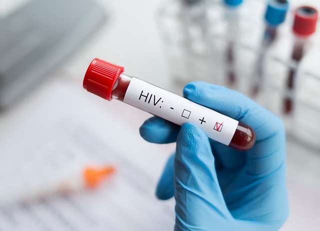 Salud estatal refuerza prevención y detección por Día Mundial del Sida