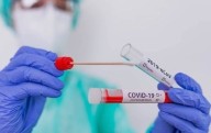 Registran 66 casos de COVID y 148 de influenza en el estado