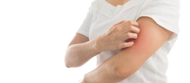 Podrían ser señales de una reacción a medicamentos