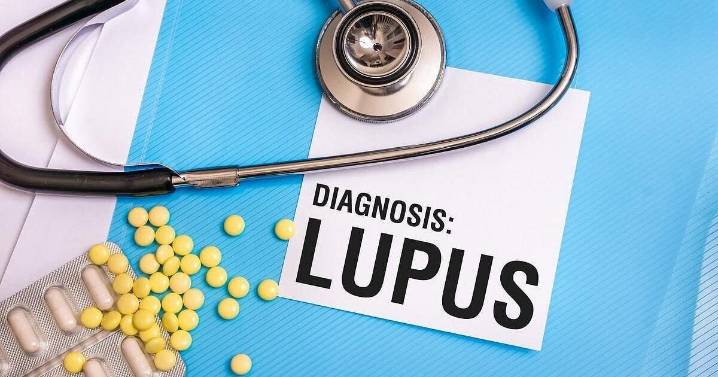 Mystery Cause Of Lupus Revealed, Experts Say