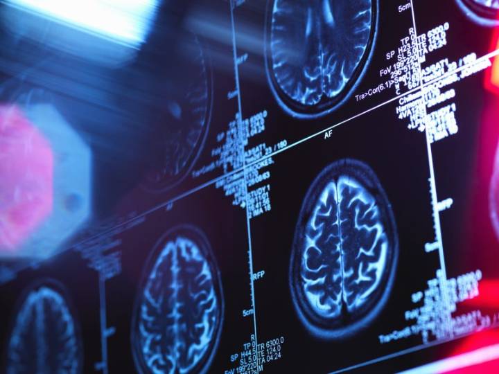 Texas approve funding for new state agency dedicated to dementia research