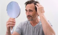 Fraudes contra la calvicie: cómo operan y qué debes saber