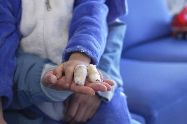 Hay recuerdos que no se borran’: Bogotá refuerza alerta tras 146 heridos por pólvora el año pasado