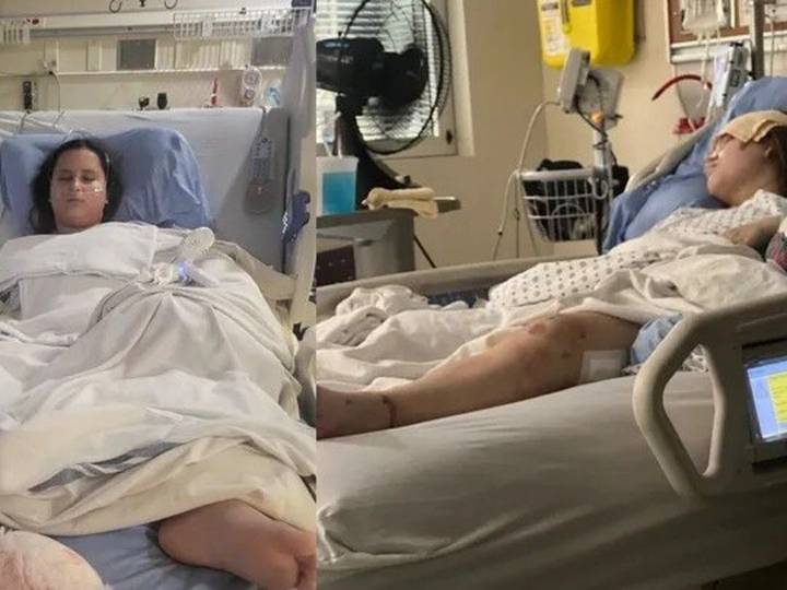 Teenage girl, younger sister pinned under vehicle at Calgary crosswalk