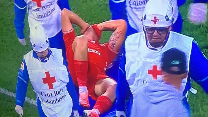 América no tuvo suerte en Copa BetPlay: dos lesionados contra Nacional en el primer tiempo