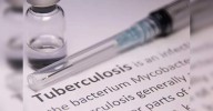 Tuberculosis killed 1.23 million last year: WHO